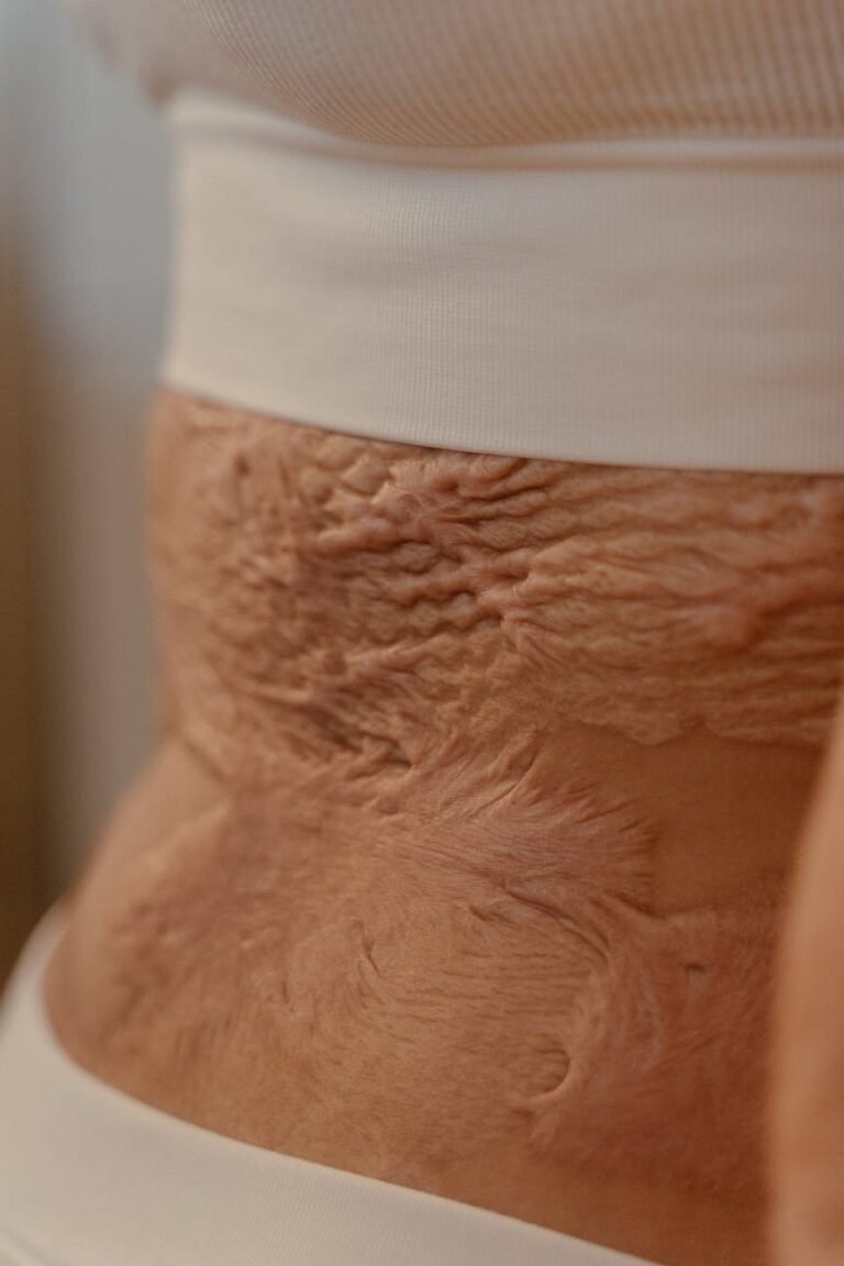 a close up shot of burn scars