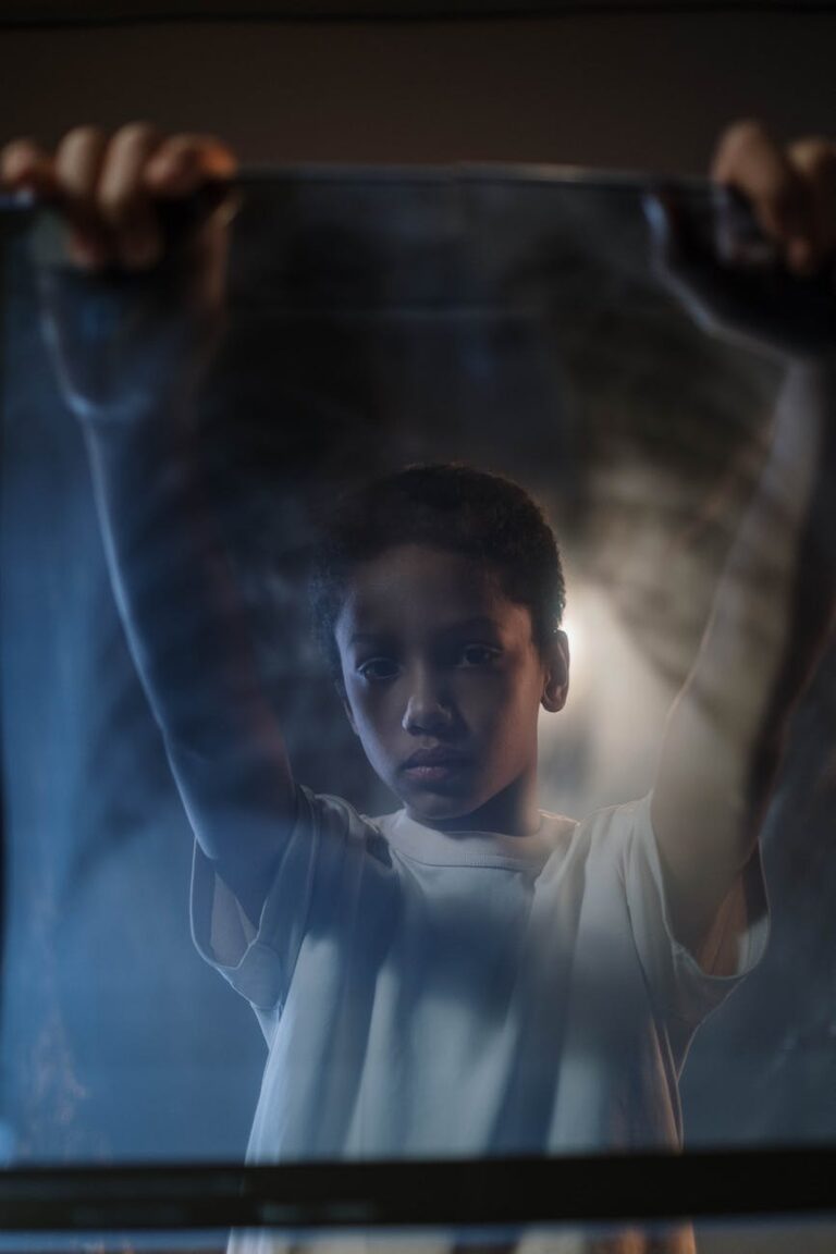 boy holding an x ray film