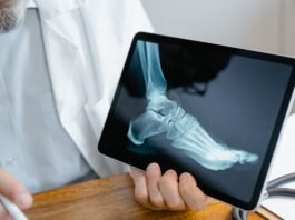 person holding an x ray result of a foot