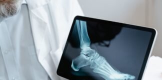 person holding an x ray result of a foot